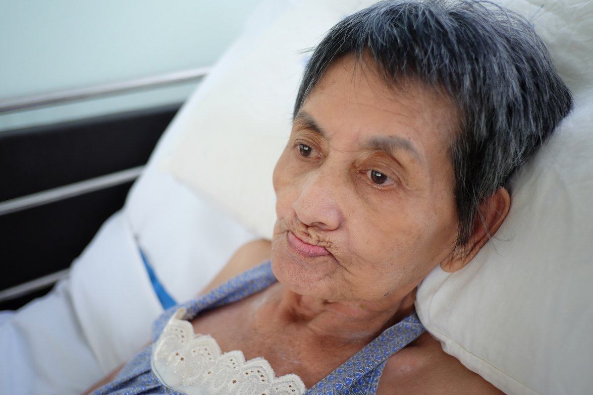 Older woman resting in bed and looking to the side.